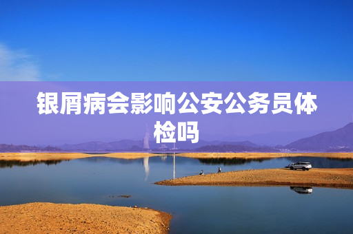 银屑病会影响公安公务员体检吗