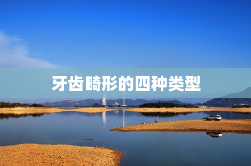 牙齿畸形的四种类型 牙齿畸形的四种类型