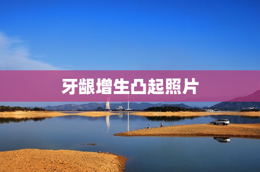 牙龈增生凸起照片 牙龈增生凸起照片