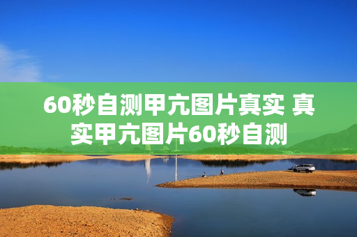 60秒自测甲亢图片真实 真实甲亢图片60秒自测